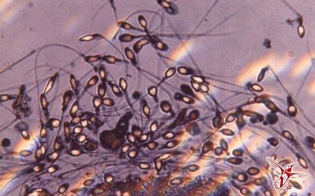 Сексуальные «пловцы»: 7 фактов о сперматозоидах